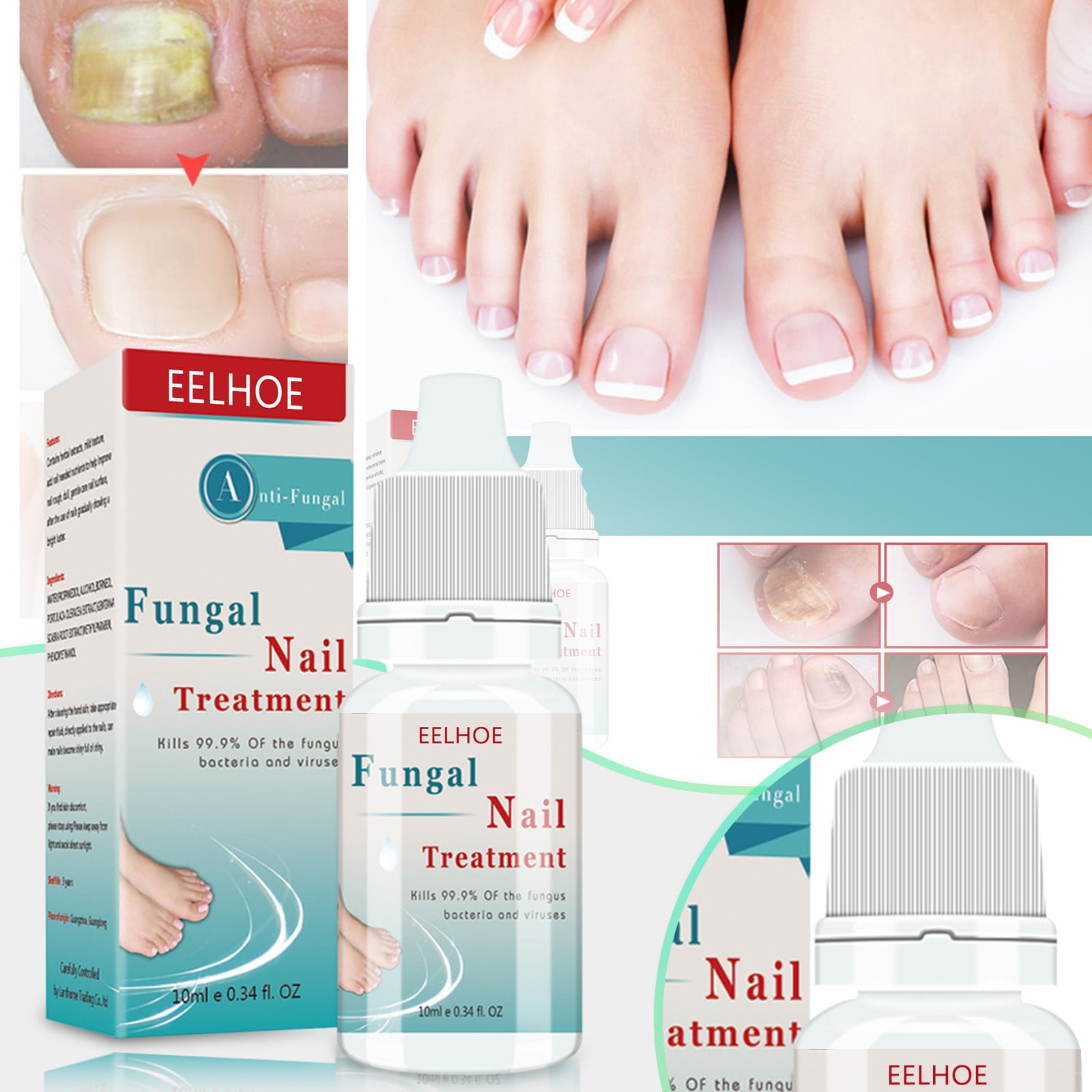 What are the different types of toenail fungus? | Guides